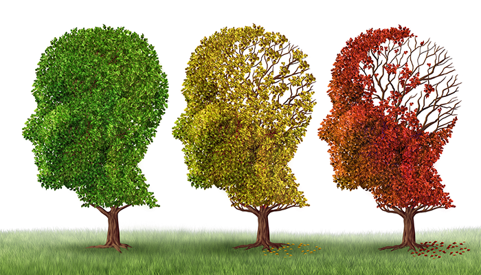 Alzheimer – nya läkemedel med oklar risk-nyttaprofil